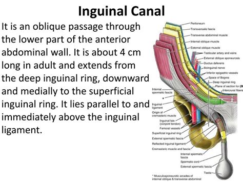 If you feel any pain, STOP!. . How to tuck into inguinal canal
